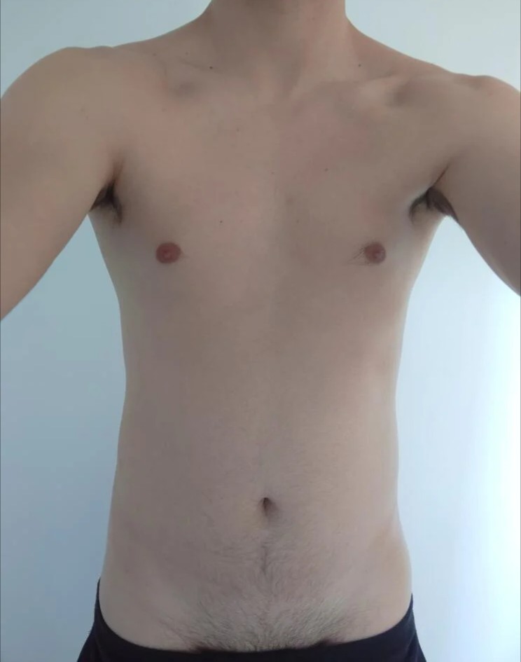 Perfil de Amadeu, 29 años, escort trans en Lardero